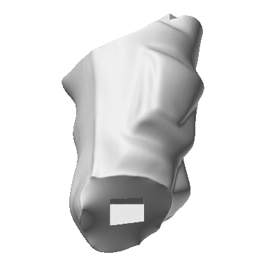 Photo of Left Thigh